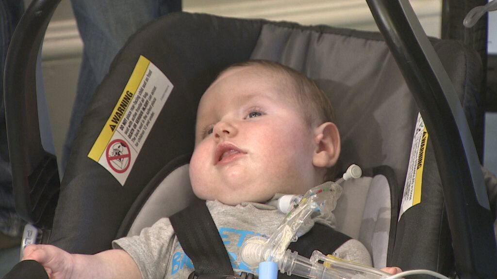 <i>WBZ</i><br/>A baby born with an extremely rare genetic condition in Massachusetts is finally set to go home for the first time since he was born. Seven-month-old Milo Alligood was discharged from Franciscan Children's Hospital on Tuesday.