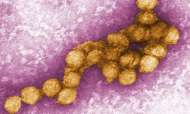An electron micrograph shows the West Nile virus