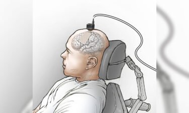 An Illustration shows placement of the eCOG electrode on the participant's speech motor cortex and the head stages used to connect the electrode to the computer.