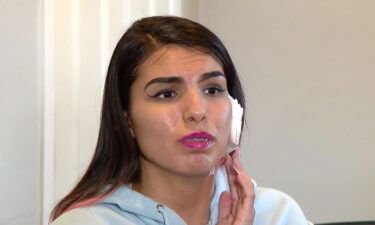 Fantacia Lopez's mouth will be wired shut for two weeks after being shot in the jaw.