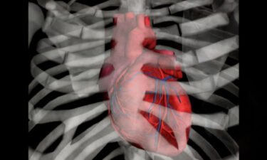 A new medication was added to the recommended treatment plan for people who have heart failure.