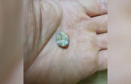 This tooth belong to a young woman who lived more than 130