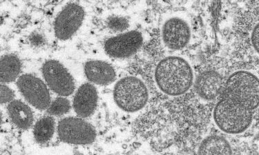 The United States is responding to a request for the release of monkeypox vaccine from the nation's Strategic National Stockpile as a global outbreak of cases is under investigation.