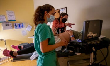 A family physician and her resident perform an ultrasound on a 25-year-old woman the day before the Supreme Court overturned Roe v. Wade at the Center for Reproductive Health clinic on Thursday