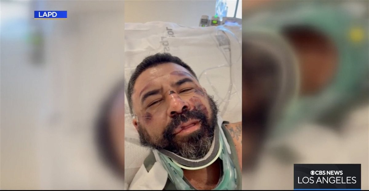 <i>Los Angeles Police Department/KCAL</i><br/>Lopez was hospitalized with 