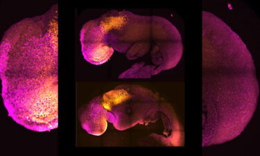 Natural (top) and synthetic (bottom) embryos are seen here to show comparable brain and heart formation.