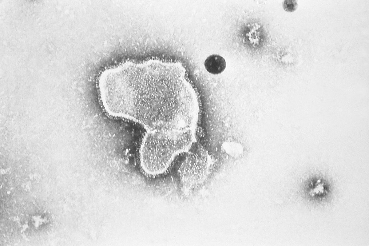 <i>CDC/AP</i><br/>The United States is dealing with a unique season of respiratory virus transmission: Flu cases are on the rise earlier than usual