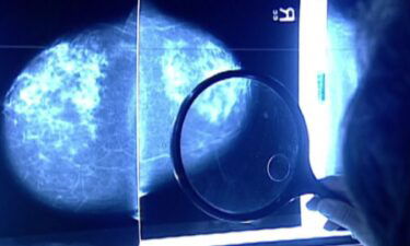 An experimental treatment shows promise for people with the most common form of advanced-stage breast cancer