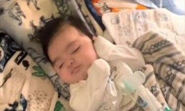 A Las Vegas infant named Niko is nicknamed ‘Baby Incredible Hulk’ for fighting a rare genetic disorder.