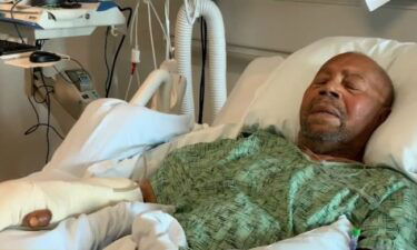 83-year-old Jimmy Lindsey from South LA man survived a mauling by the neighbor's dogs in his own front yard.
