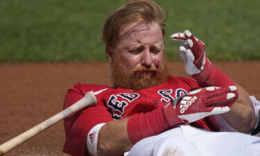 Boston Red Sox third baseman Justin Turner reacts after being hit in the face by a pitch by Detroit Tigers pitcher Matt Manning in the first inning.