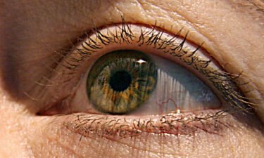 Research has been exploring how the eye may help in diagnosing Alzheimer's disease before symptoms begin.