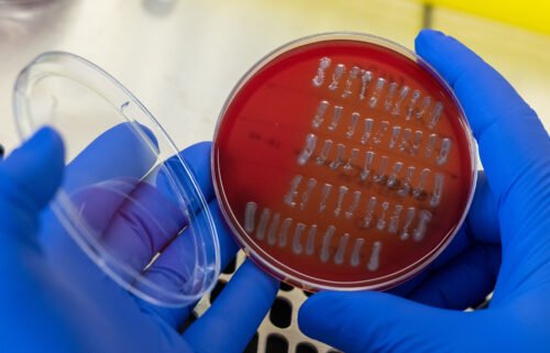 Researchers have long known of a link between E. coli and UTIs