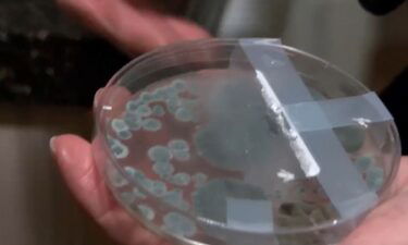 A woman says mold is forcing her out of her Overland Park