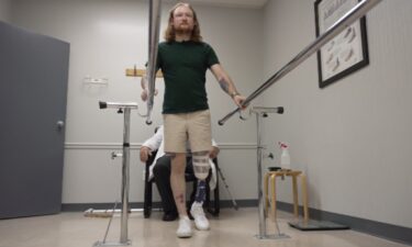 Reum allowed CBS 2's cameras to capture him taking his very first steps without his crutches. Prosthetist Norbert Fliess coached him through it. Reum will need hours of therapy to get him up to speed.