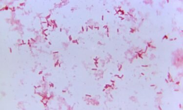 Plague is caused by the bacterium Yersinia pestis.