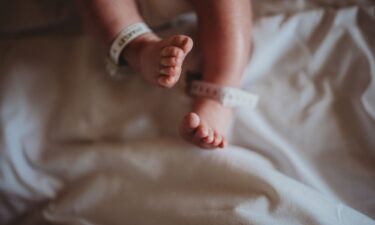 The infant mortality rate was higher than expected in the US in several months after the Dobbs decision and never dropped to rates that were lower than expected